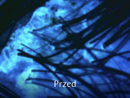 Zbliżenie na skórę głowy z widocznymi włosami przed zastosowaniem produktu.